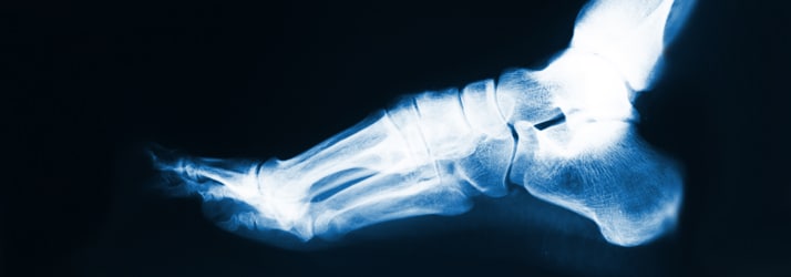 Chiropractic Hernando MS X-Ray Chiropractic Hernando MS X-Ray